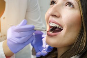 5 cosas que hay que tener en cuenta al plantearse una ortodoncia